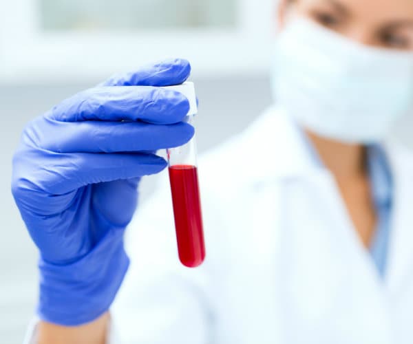 Medical First: Blood Test Detects Parkinson's Disease 