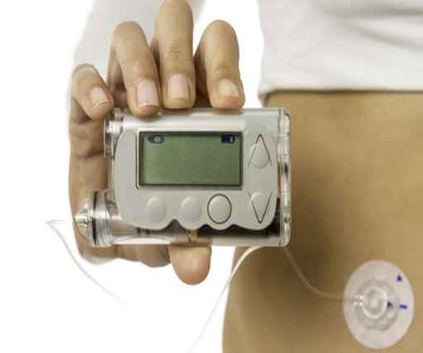 Insulin Pumps Help Kids Control Type 1 Diabetes