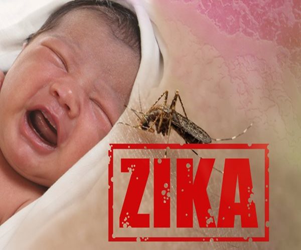  Single Genetic Glitch May Explain Zika Birth Defects