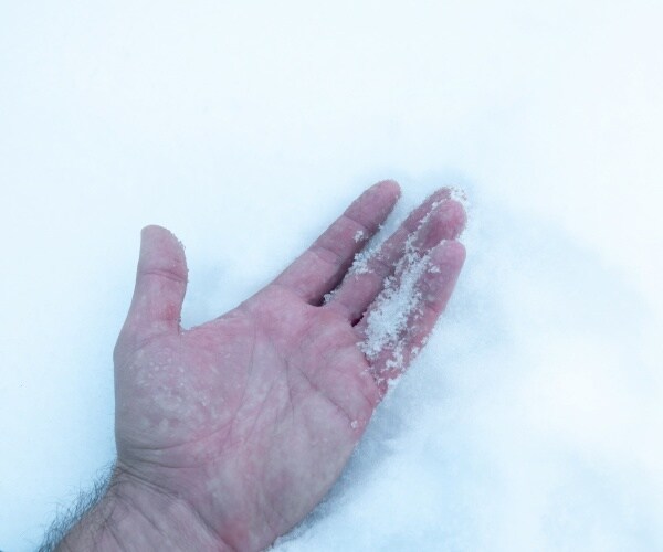 man's hand in snow with frostbite