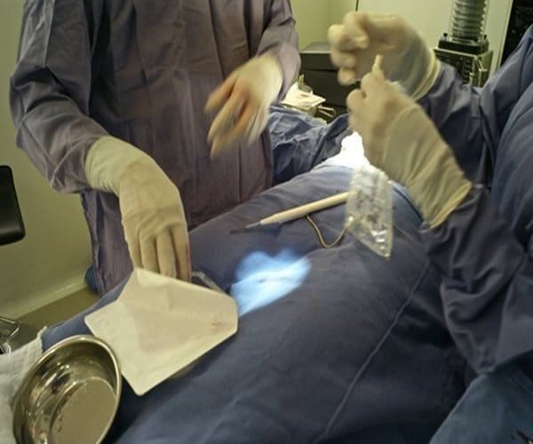 General Surgeon Shortage Growing Across America