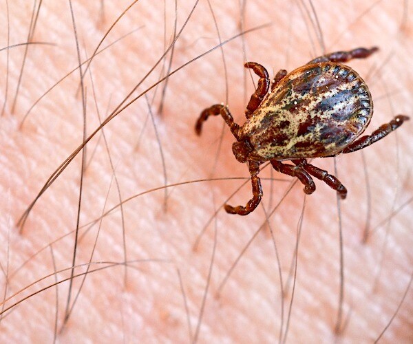 a tick crawls on a man's hairy skin