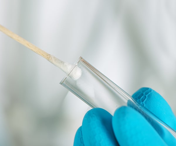 Dating Site Uses DNA Swab to Find Matches