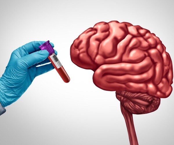 illustration of a hand with a blue glove holding a blood sample next to a brain