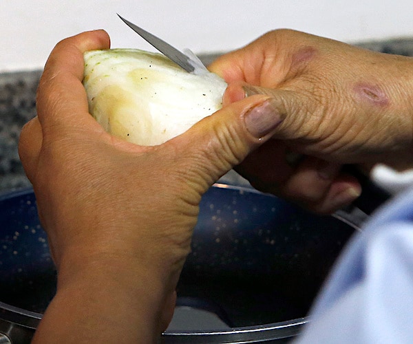 a woman with arthritis and cuts on her hands cuts into an onion