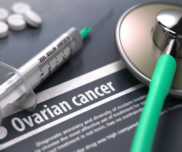 Exercise to Lower Ovarian Cancer Risk