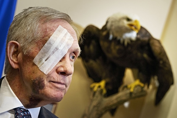 Harry Reid Not Letting Fitness Accident Slow Him Down