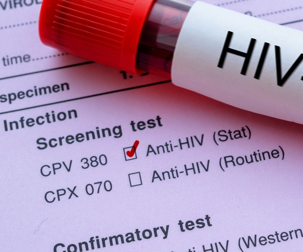 15 Percent of Americans With HIV Infection Don't Know It