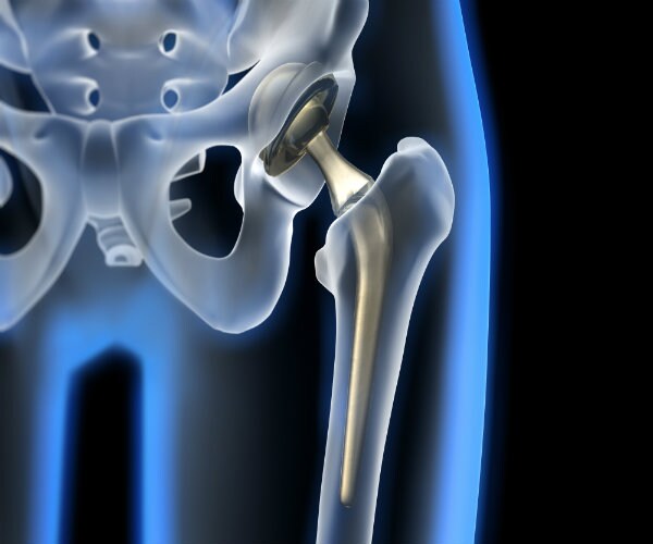 Experimental Stem Cell Therapy Reverses Osteoporosis