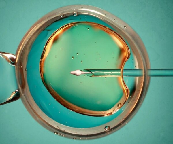 illustration of one step of IVF procedure