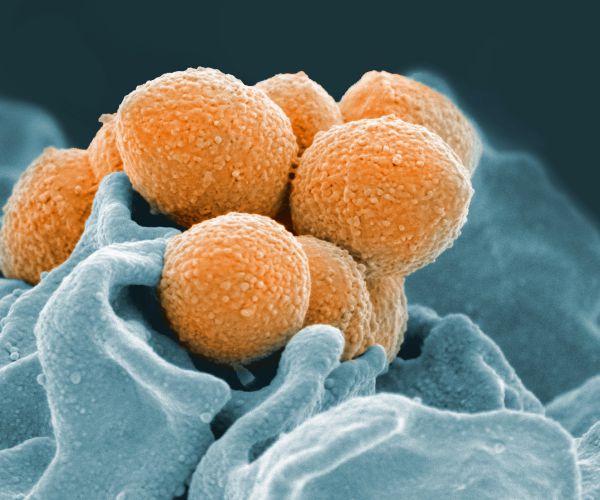 Study: Climate Change Linked To Rise in Severe Bacterial Infection