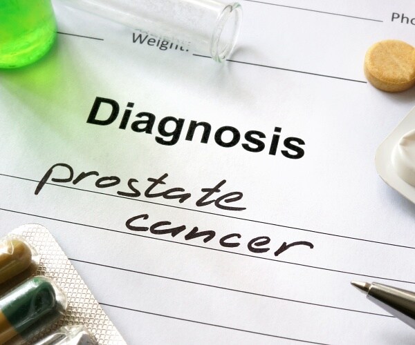 prostate cancer written on medical pad