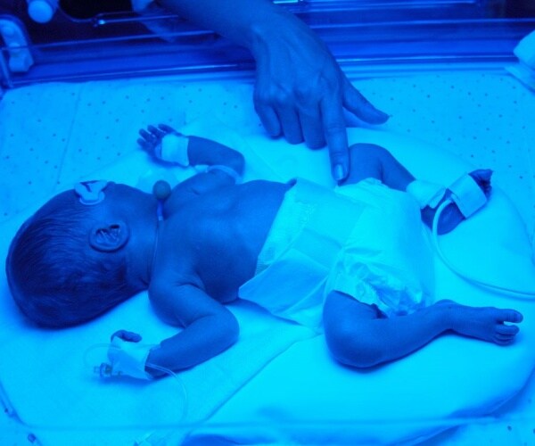 premature baby in incubator