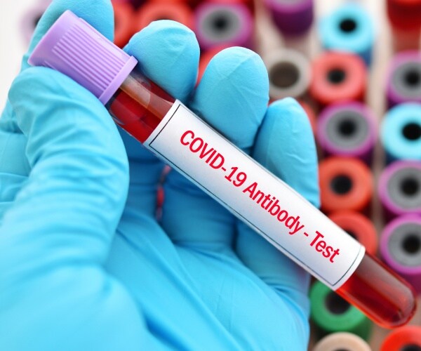 COVID antibody test vial of blood