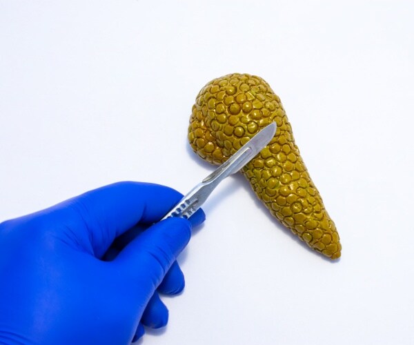 hand with surgical glove holding a knife to a model of a pancreas