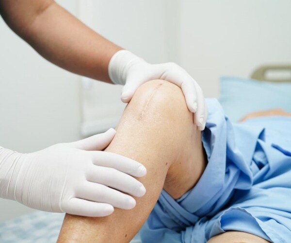 doctor looking at patient's knee after knee replacement surgery