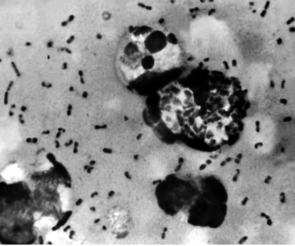 China's Inner Mongolia Region Reports Bubonic Plague Case