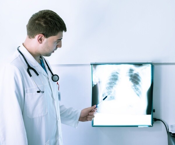 doctor pointing out lung cancer on x-ray