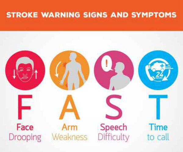 Experimental Drug Can Prevent Strokes