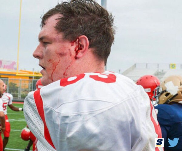 NYPD, FDNY Fight Breaks Out During Annual Charity Football Game