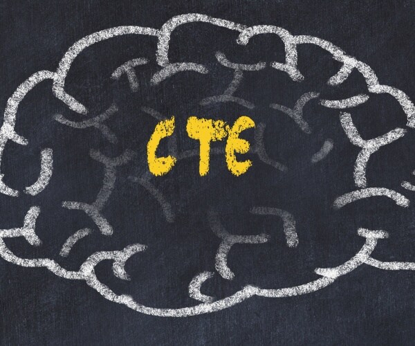 illustration of brain with CTE written in middle