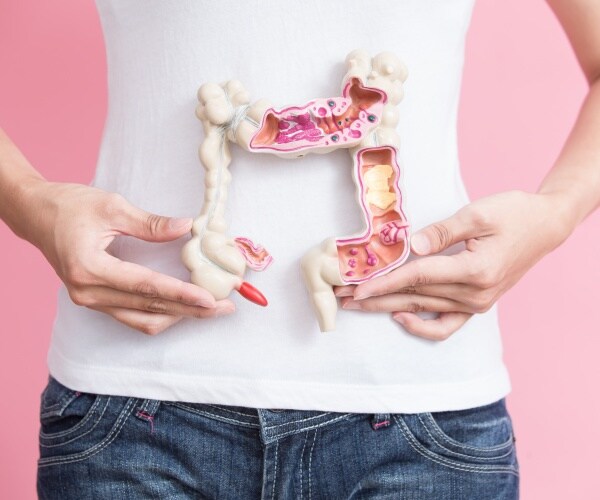 young woman with model of colon in front showing colorectal cancer