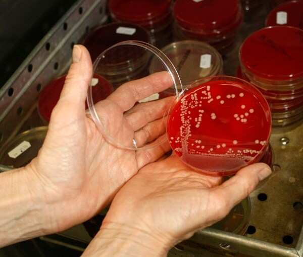 Superbug Deaths: Resistant Scourge Could Be Killing 10M Yearly by 2050