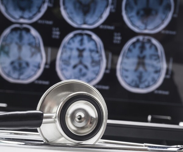 x-rays of the brain and stethoscope