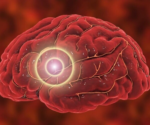 illustration of brain with a spot highlighted to show stroke