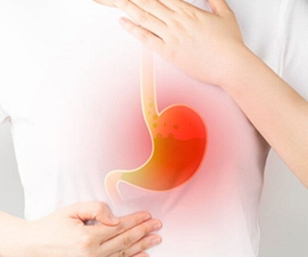 illustration of what happens in stomach, GI tract during heartburn