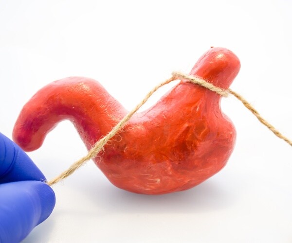 gloved hand pulling string around model of stomach to indicate weight-loss surgery