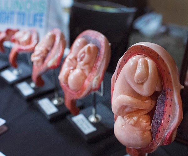 Rep. Black: PP Videos Show US You Get Fetal Organs 'From a Baby'