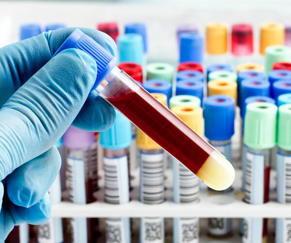 Parkinson's Blood Test Could Help Doctors Differentiate Disorder