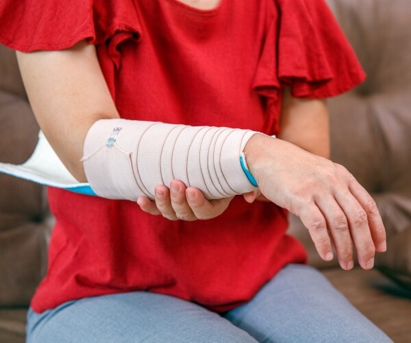 woman with arm in splint