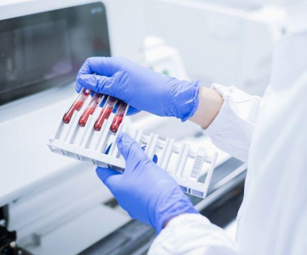 vials of blood in lab for testing