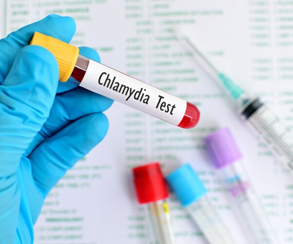 Chlamydia Vaccine for STD May Be Nearer, Say Researchers