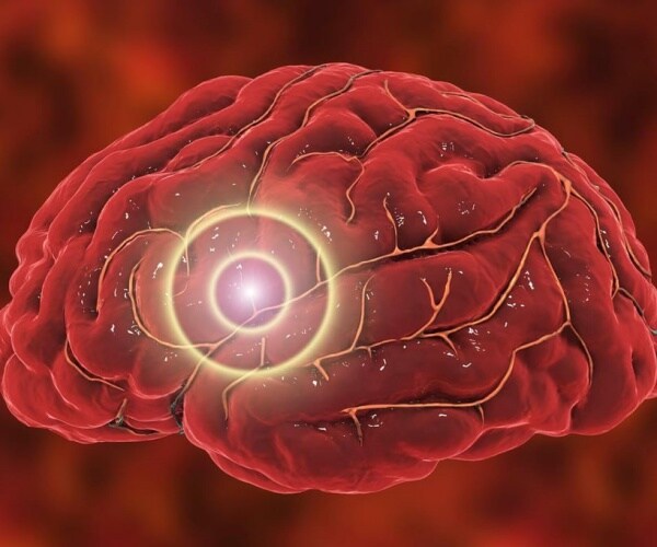 illustration of brain with a light in area of brain stimulation treatment