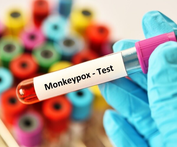 vial of blood labeled 'monkeypox test'