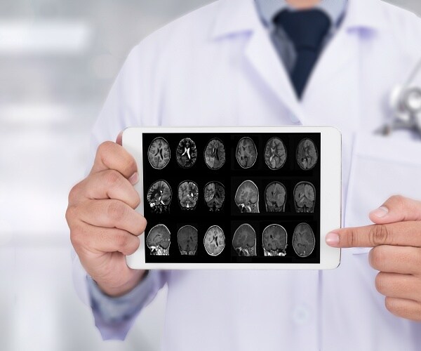 doctor holding tablet showing brain scans