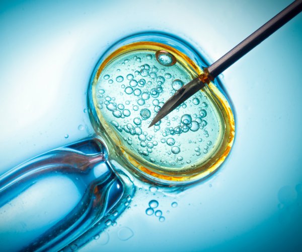 in vitro fertilization