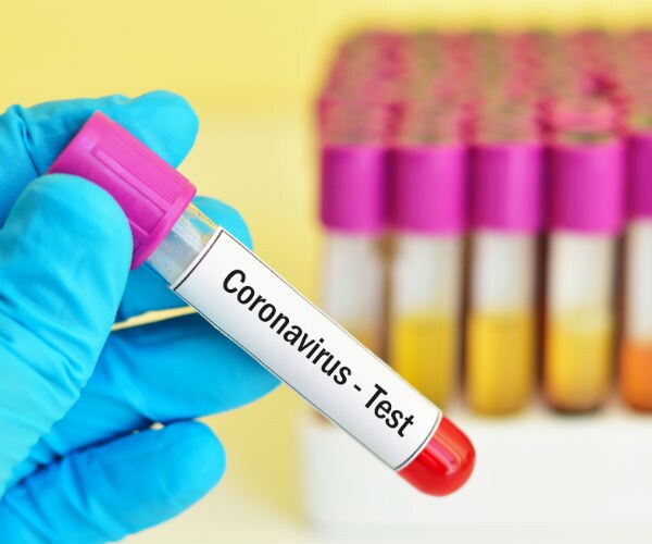 test tube with blood sample for coronavirus test