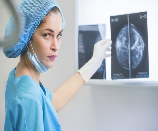 Surgeon holding up film of mammogram results