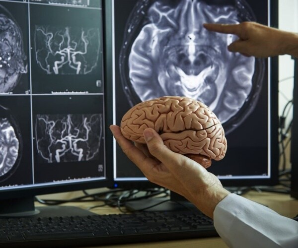 scientist holding brain model and looking at brain mri scans