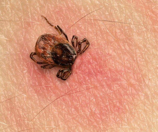 Urine Test Revolutionizes Lyme Disease Detection