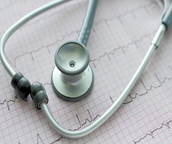 a stethoscope lying on top of a print out of an ECG