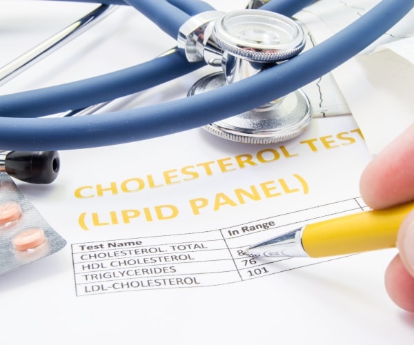 results from panel of cholesterol tests