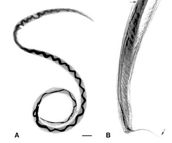 Hawaii Brain Parasite: Cases of Rat Lungworm Disease Number 9