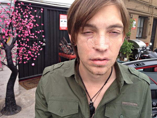 Alex Band Abducted: The Calling's Reunion Coincides With Beating