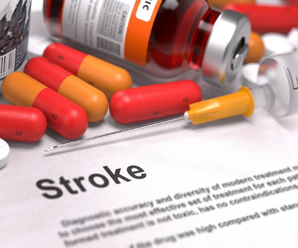 Stroke Rising Among Younger Adults