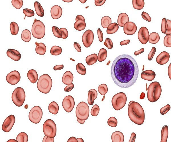 3D illustration of iron deficiency anemia